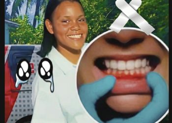 SALEN DETALLES PREOCUPANTES