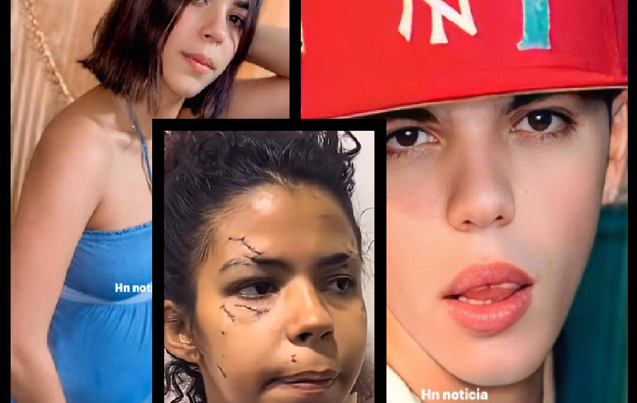 LA SUPERVIVIENTE HABLA ANTE LAS CAMARAS